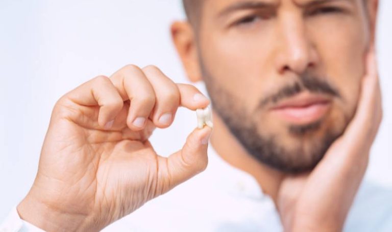 Qué causa la pérdida de dientes