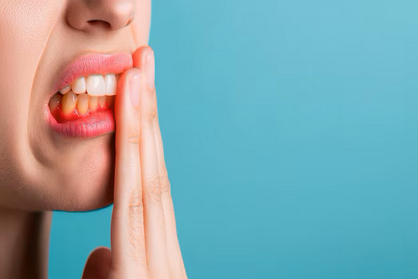 Peri-implantitis