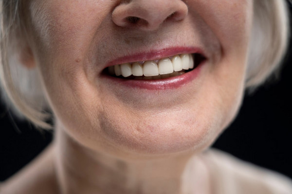 Comprendiendo las dentaduras postizas