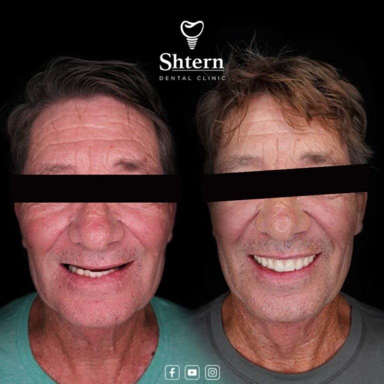 Cancun Dental Care 1