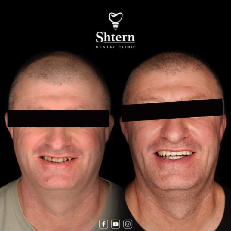 Cancun Dental Care 3