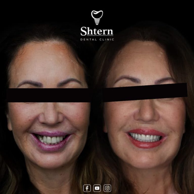 Cancun Dental Care 4