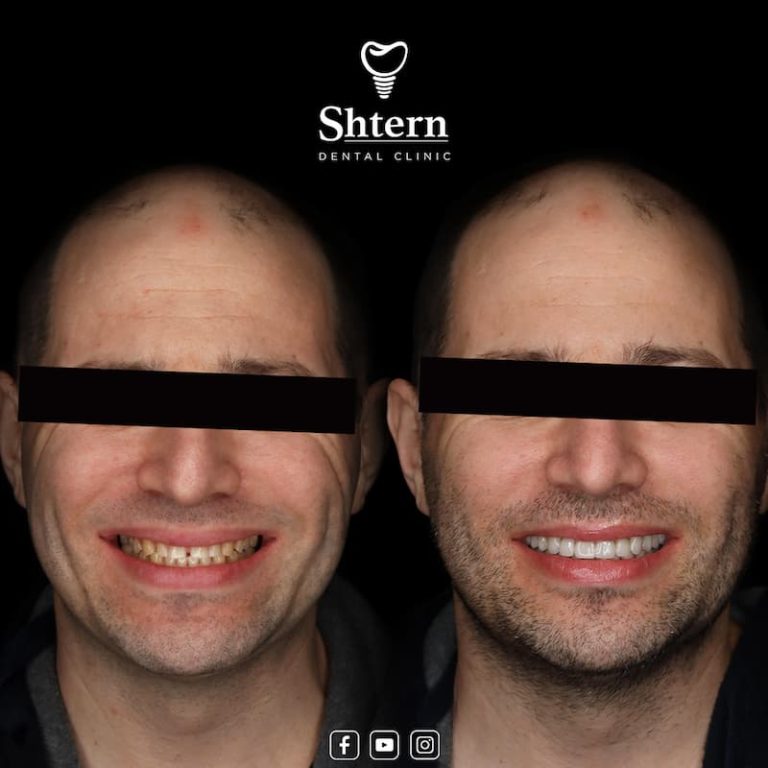 cancnun dentist