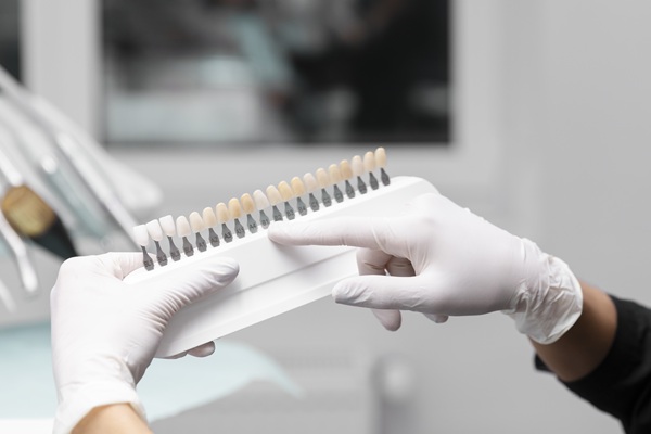 Sonrisa Hollywood cómo elegir el tono de blanco