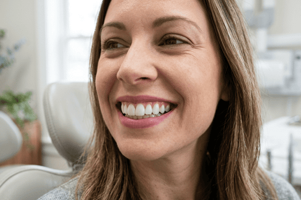 Non-shave veneers