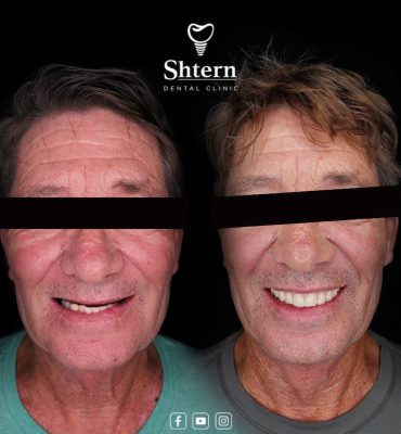 Cancun Dental Care 1