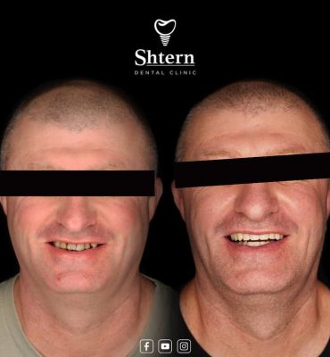 Cancun Dental Care 3