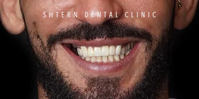 After dental implants, patient at Shtern Dental Clinic Cancun
